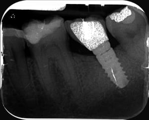 Bmnomqk1z9r8csniup7du5foyqfp - Eugenol