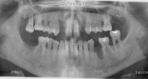 Bonnalolivia79522img1 og2urr - Eugenol