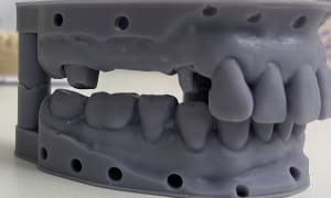 Brat2q72ixnlzir7xstwcxxbj806 - Eugenol