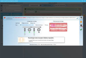 Bridge 2 zk1hhn - Eugenol