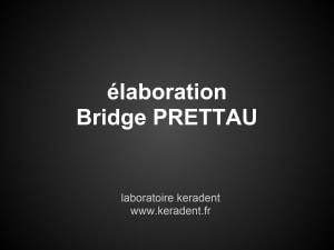 Bridge prettau lydtoi - Eugenol