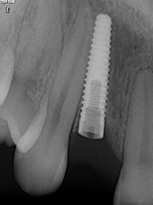 C est quoi - Eugenol