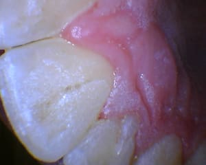 Camerachinoise 2018 11 26 184429 iubtrt - Eugenol