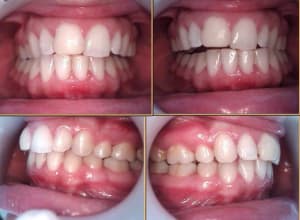 Cas2 gshaai - Eugenol