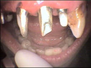 Cas 3 1 en3hrz - Eugenol