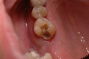 Cavite prete xki7xe - Eugenol