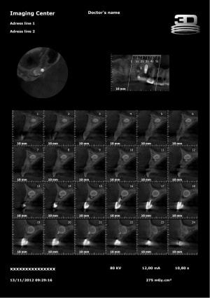 Cbvt n6iiht - Eugenol