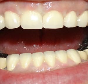 Ccm ht et bs apr s trvx cdaw46 - Eugenol