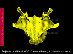Chirurgie guidée 020 hlx8kw - Eugenol