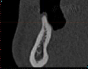 Cross section dhvkc8 - Eugenol