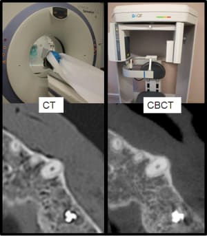 Ct vs cbct wsymvq - Eugenol