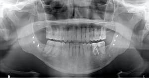 Cukxhcjwzjrnpdnm4r0h - Eugenol