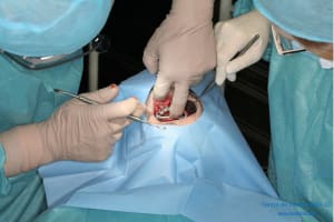 Déoulé d une mci dr r - Eugenol