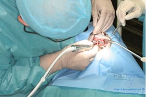 Déoulé d une mci dr r - Eugenol