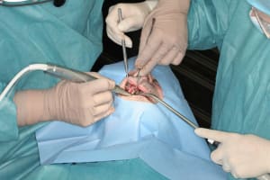 Déoulé d une mci dr r - Eugenol