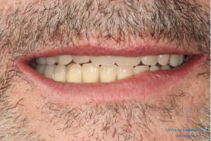 Déoulé d une mci dr r - Eugenol