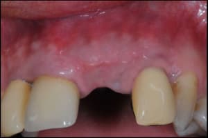 D57 cekjgi - Eugenol