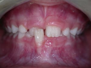 D but ilq2eg - Eugenol