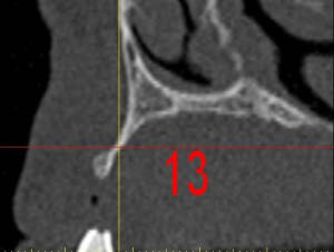 Dar13 daauc7 - Eugenol
