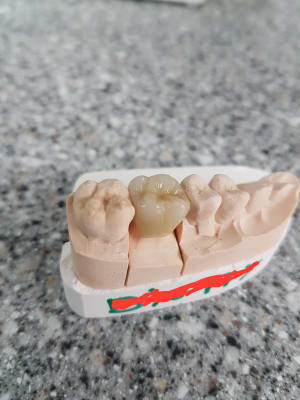 Dent1 jdpab2 - Eugenol