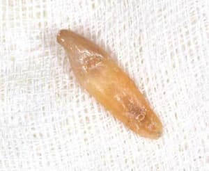 Dent nettoyee hd9rhq - Eugenol