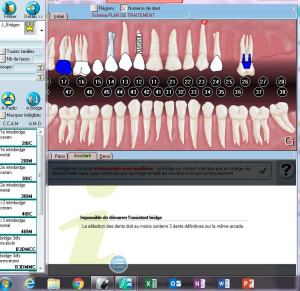 Devis bridge julie mki9jt - Eugenol