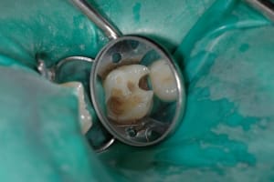 Dsc 2659 fgvsav - Eugenol