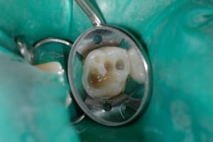 Dsc 2665 vfhehz - Eugenol