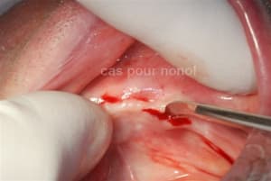 E1653e woshne - Eugenol