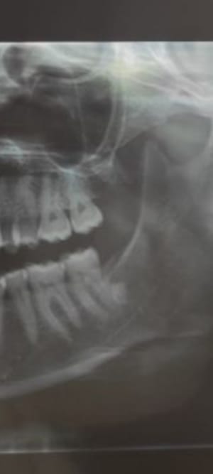 Ek7z0lrvb9goln5fhknw1vw8r6co - Eugenol