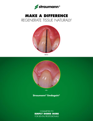 Emdogain dloe5d - Eugenol