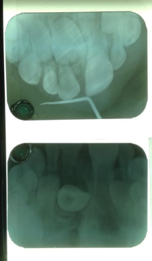 Emilio  1  tgf9rq - Eugenol