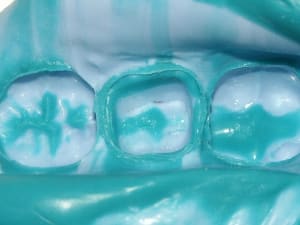 Empreinte jdvrmk - Eugenol