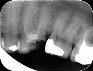 Endo1 ijxvqt - Eugenol