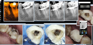 Endo 37 3 onh8iy - Eugenol