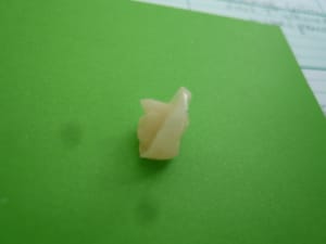 Endo coiffe 001 v5i3wo - Eugenol