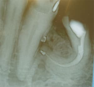 Endo vjzkps - Eugenol