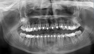 Eunju2n7fnwiz1tchifa - Eugenol