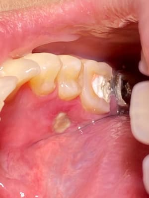 Ew0pzumijyjbm7i6ji33 - Eugenol