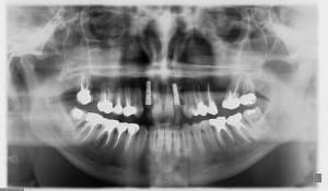 Exemple t4qmlu - Eugenol