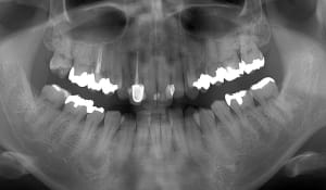 Ezypcyngea7cnd4f6bss - Eugenol