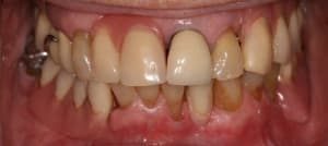 Face f3cuct - Eugenol