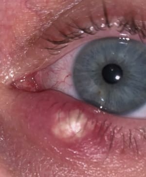 Fbj3ve3n4ekd8tdsvgwl - Eugenol