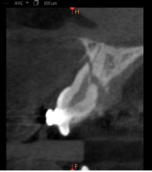 Fefssyo57ohgp8nwrrqo - Eugenol