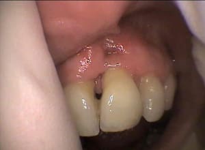 Fev2012 exzmhk - Eugenol