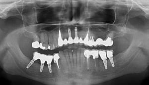 Fin de ttt hua2dt - Eugenol