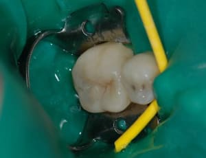 Fin fur95d - Eugenol
