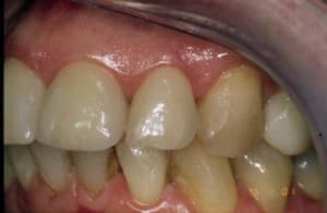 Final gauche vq1c8x - Eugenol