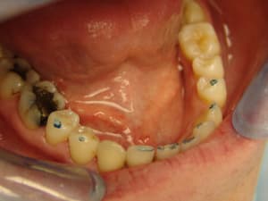Fn2 rvhdoi - Eugenol