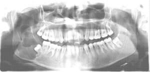 Fur hfbslf - Eugenol